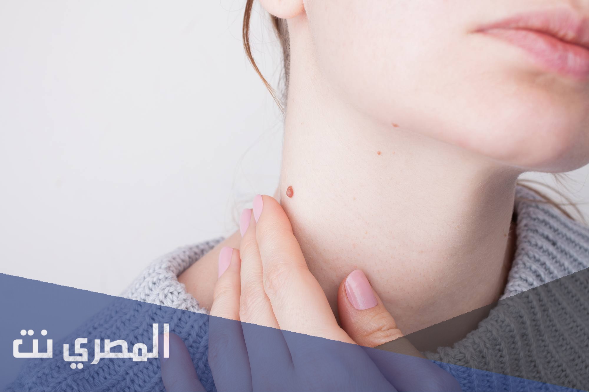 أفضل علاج لإزالة الثالول من الجلد