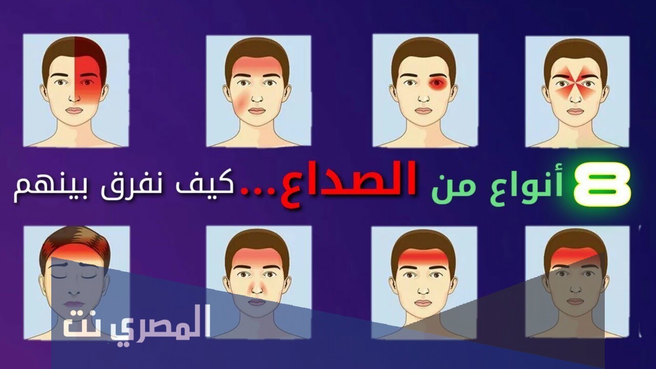 اسباب الصداع الامامي