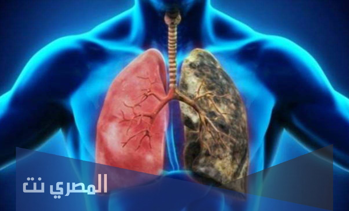 اعراض الانسداد الرئوي المزمن