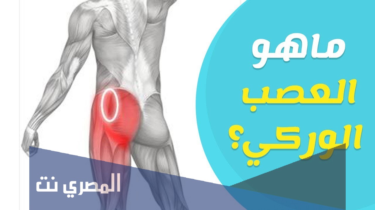 التهاب العصب الوركي واعراضه