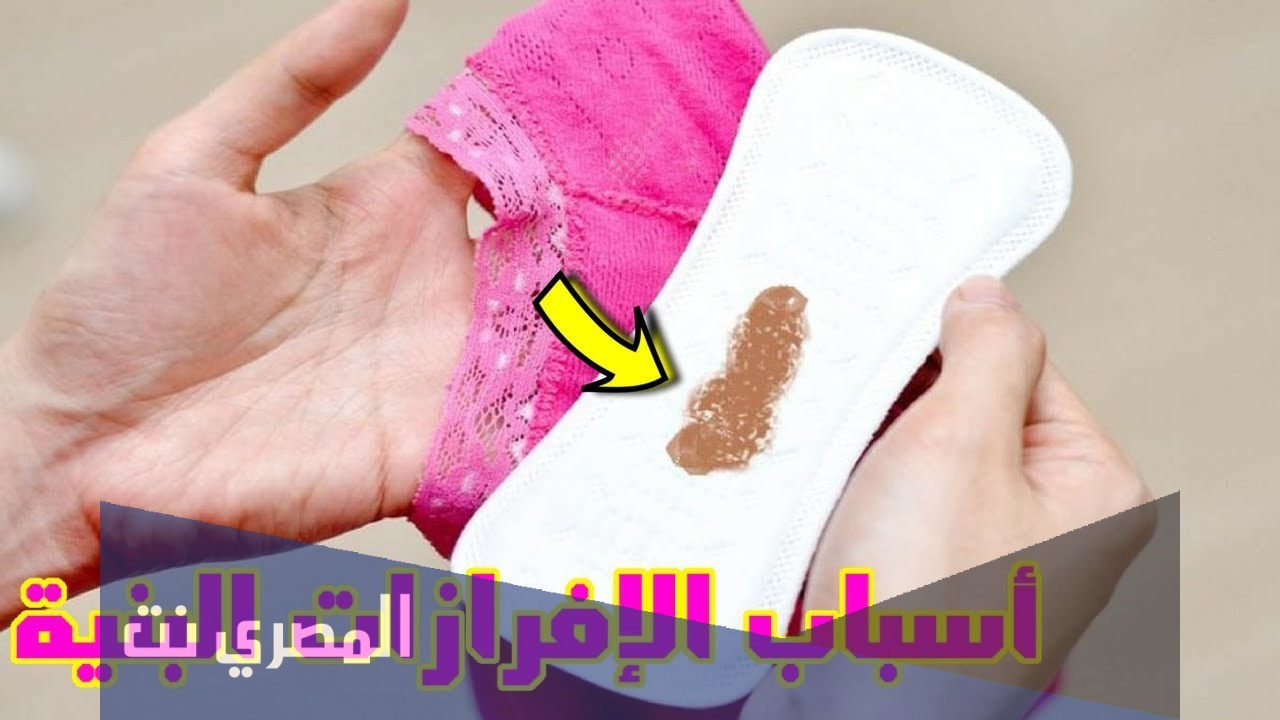 حكم الصوم مع وجود افرازات بنيه