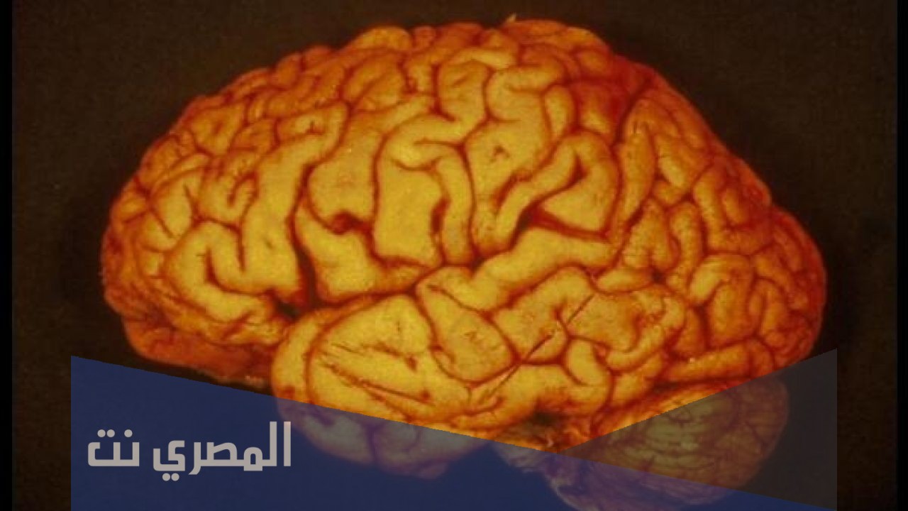 ضمور المخيخ عند الكبار وكيفية علاجه