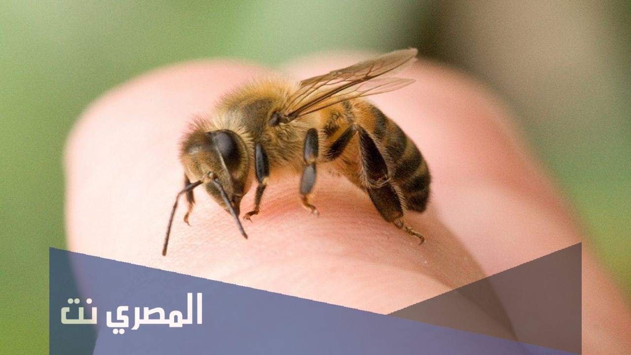 علاج حساسية لسعات النحل