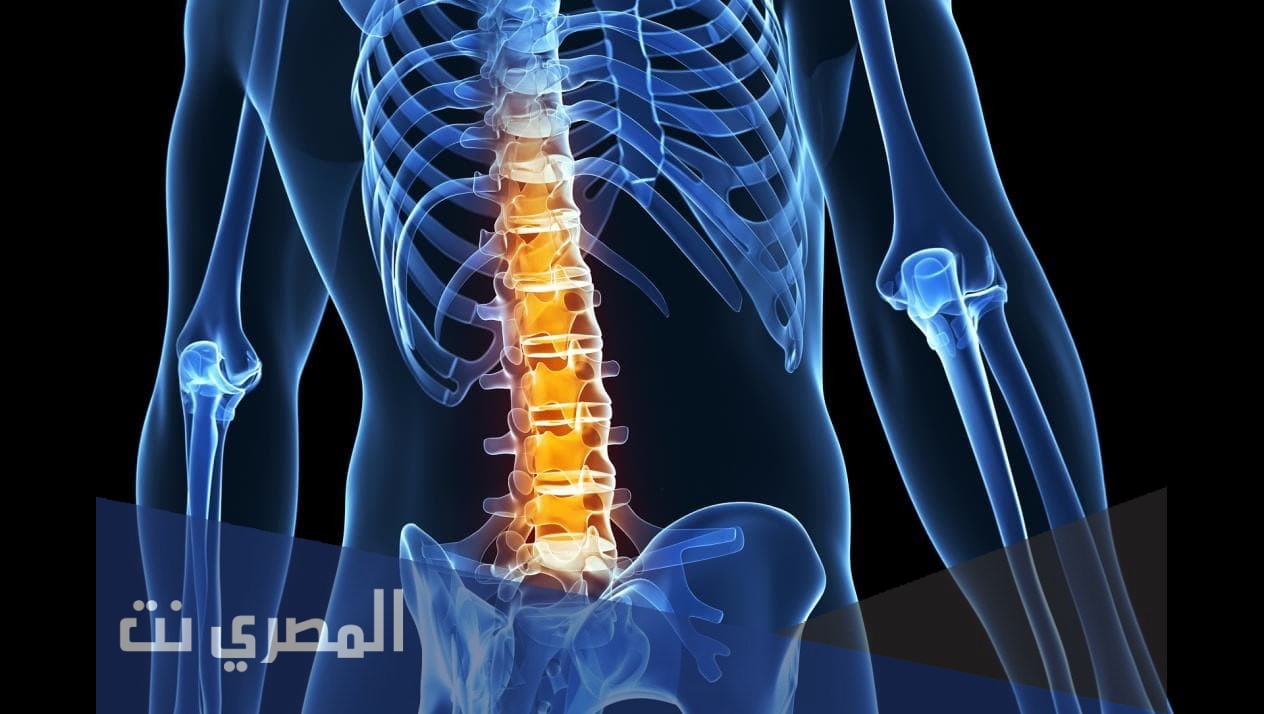 علاج خشونه المفاصل والفقرات