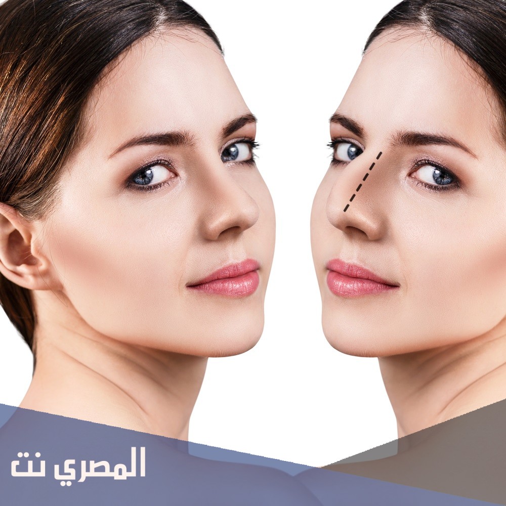 عملية تجميل الأنف .. التكلفة والمخاطر