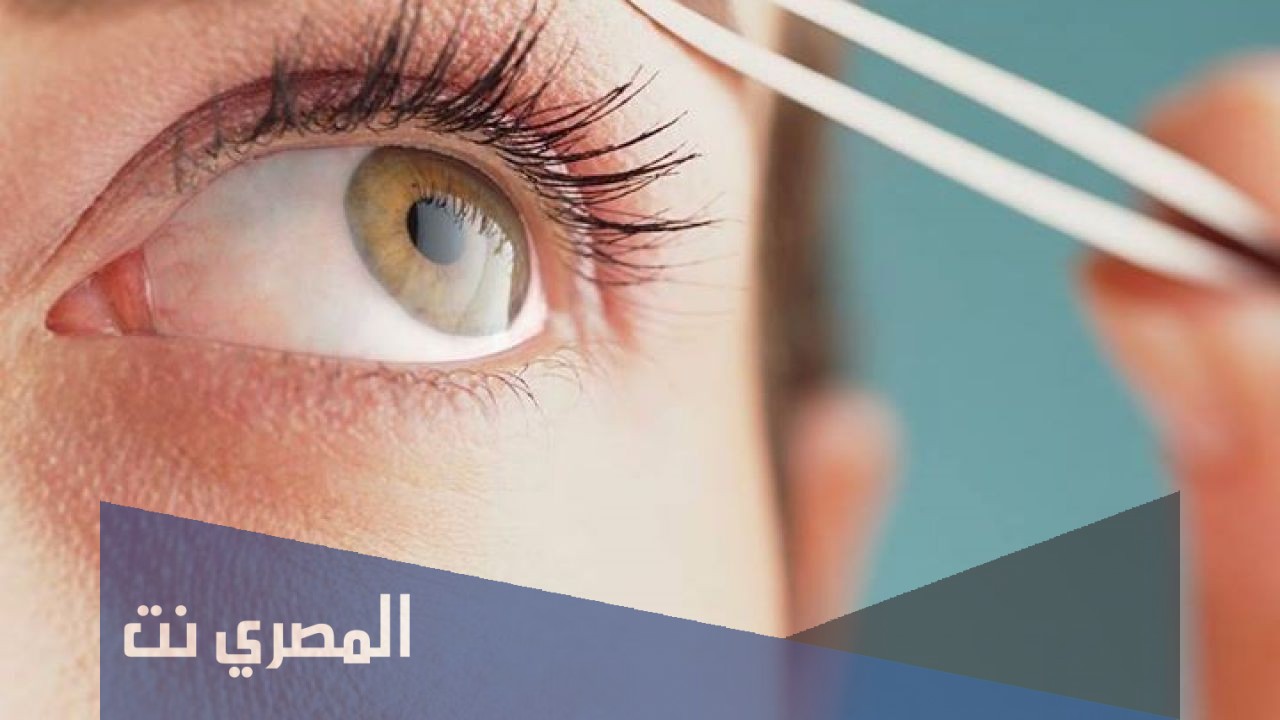 ما هو النمص في الإسلام