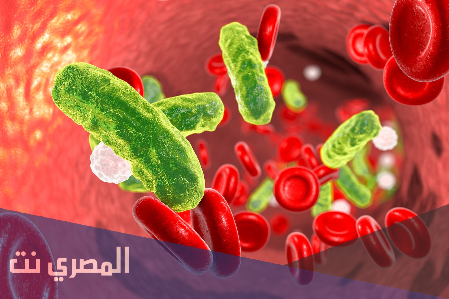 ما هو تسمم الدم وأعراضه؟