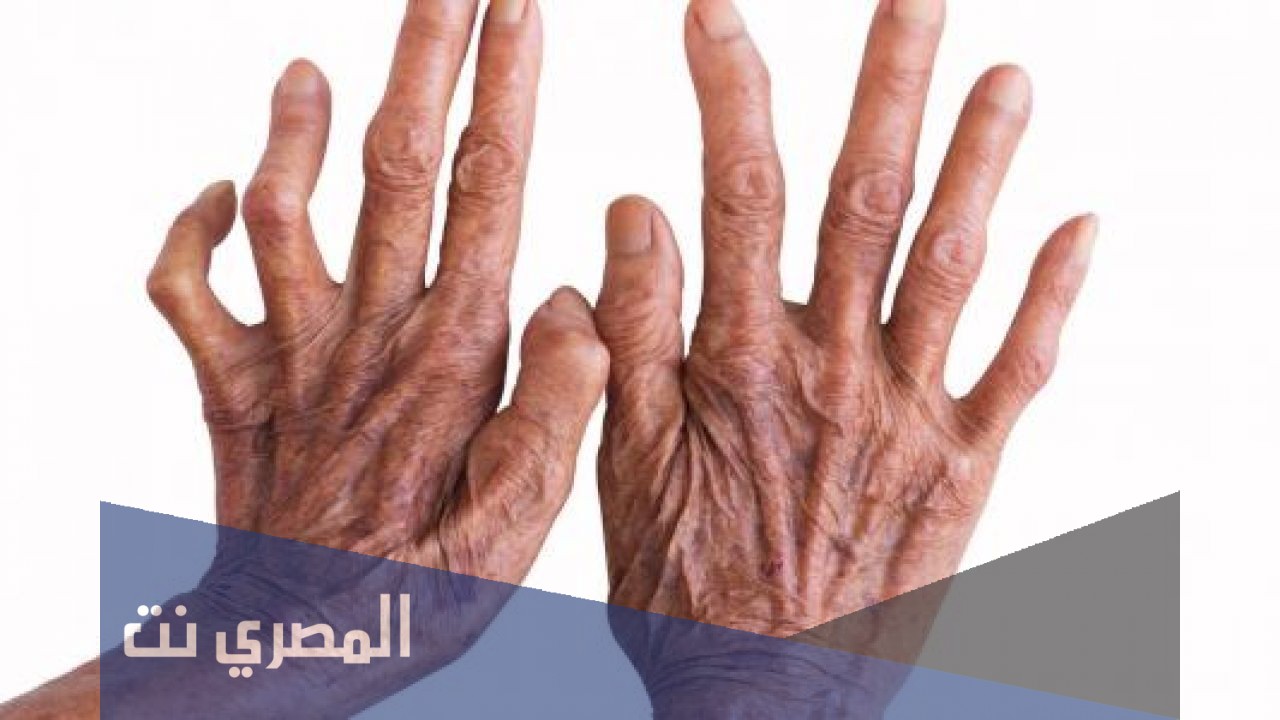 ما هي مضاعفات مرض الجذام؟