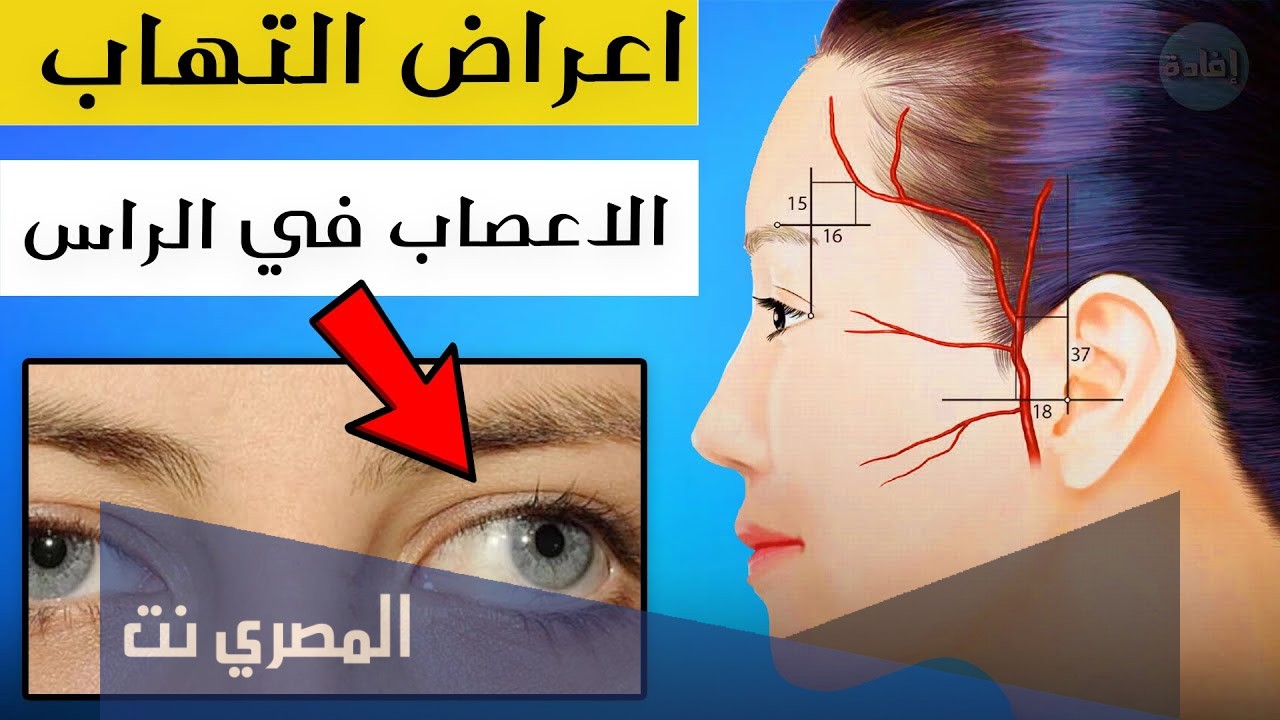 معلومات عن اعراض التهاب الاعصاب في الرأس
