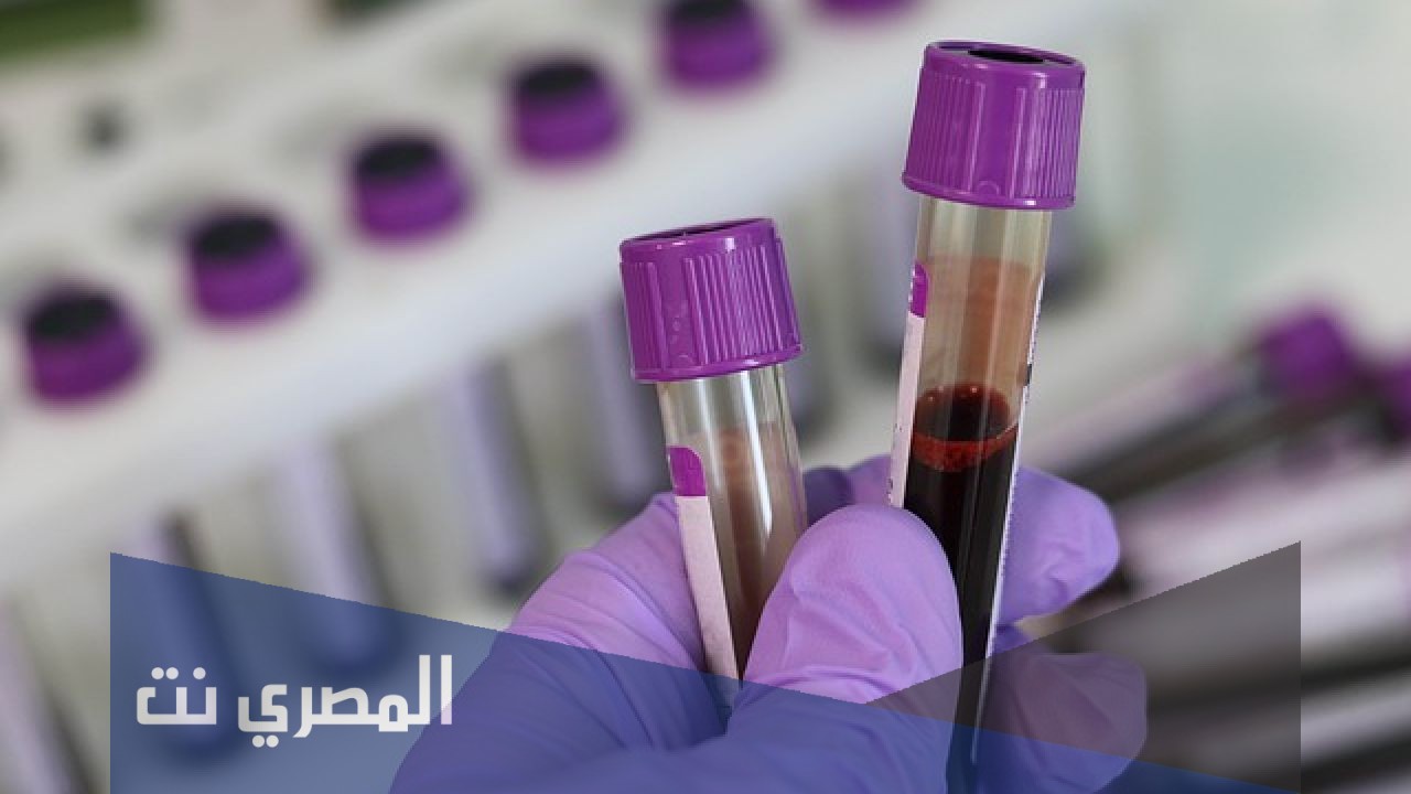 هل تحليل الدم يفطر الصائم؟