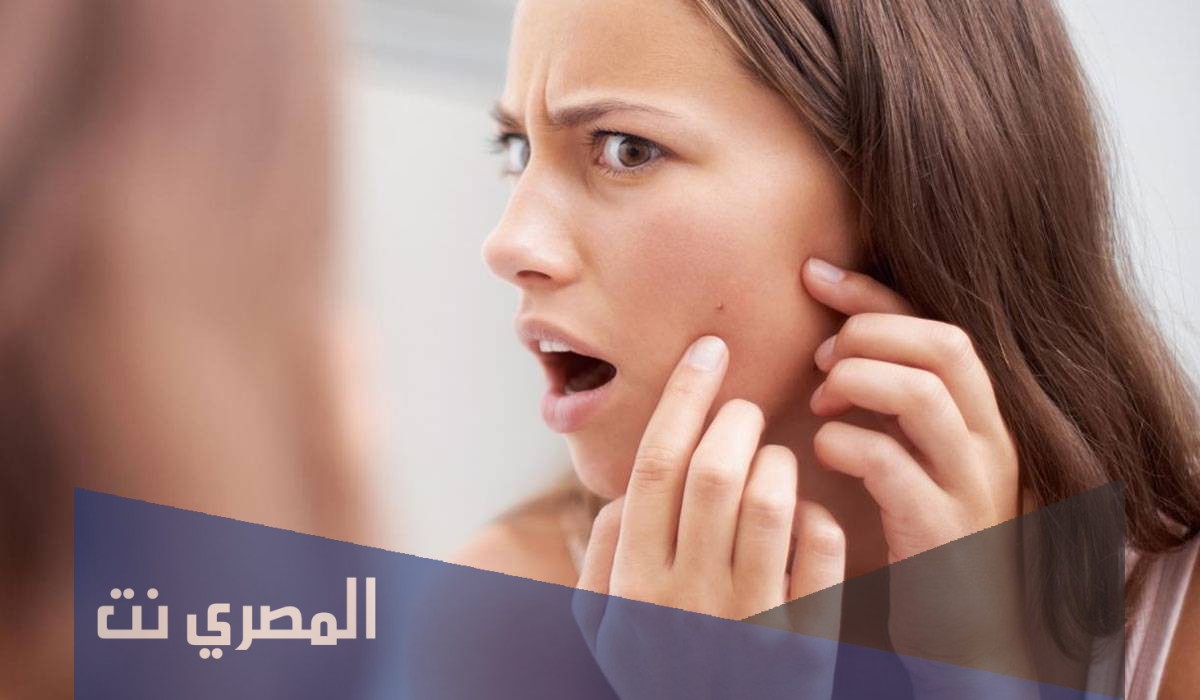 هل ظهور الحبوب من علامات الحمل المبكرة؟