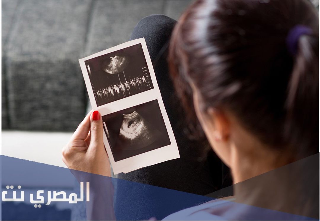 هل يخطئ السونار في تحديد نوع الجنين في الشهر الرابع