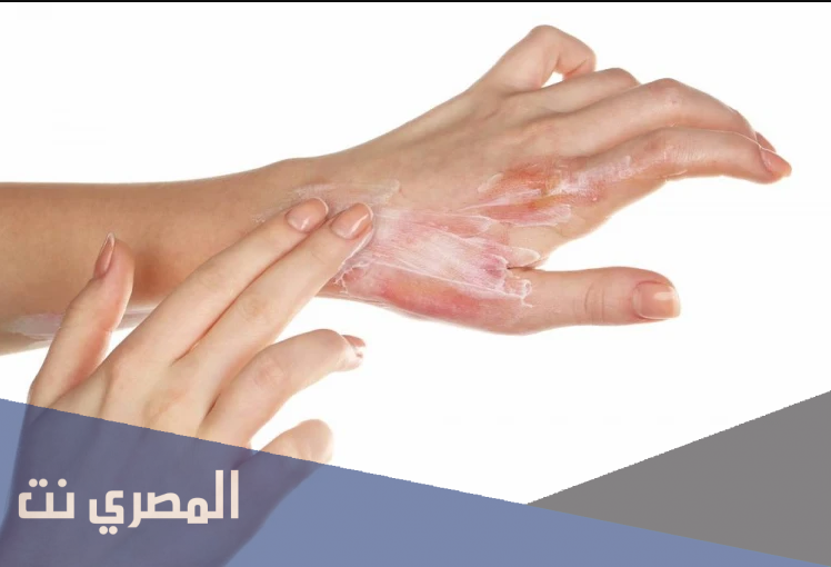 كريم بوكا Pukka لالتئام الجروح وعلاج الحروق