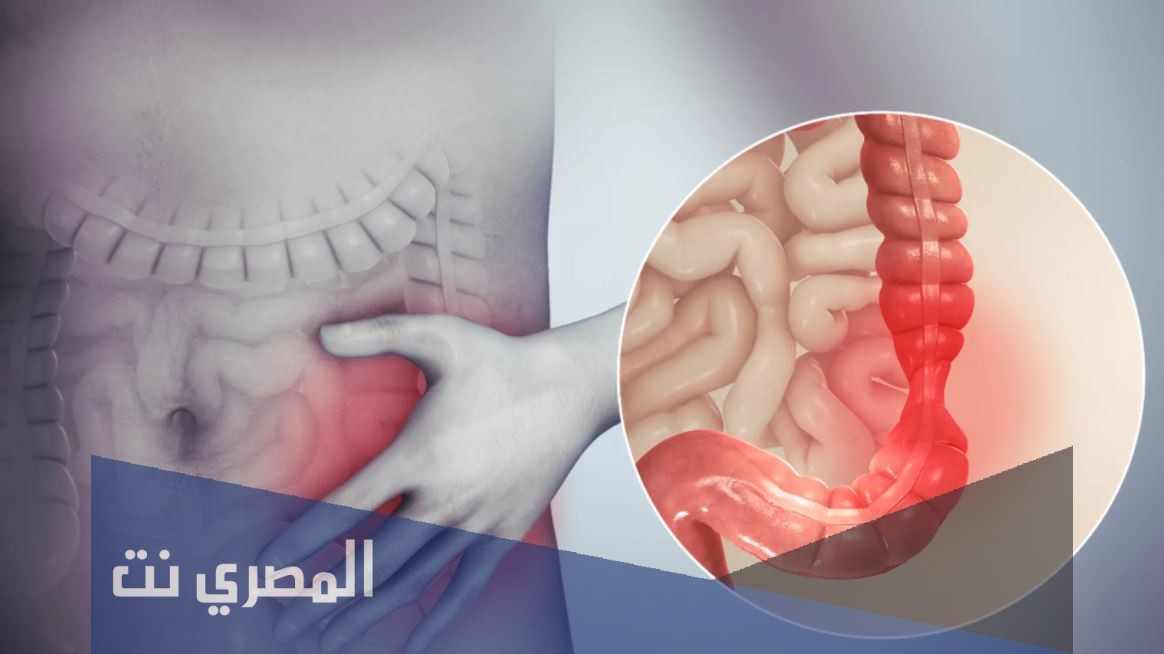 ما هو أفضل علاج للقولون العصبي مجرب