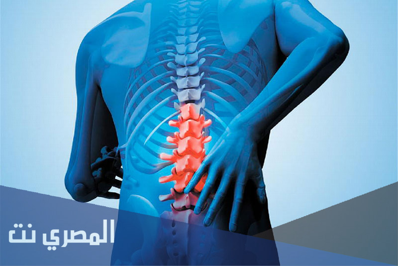 أليندرو Alendro علاج جراحة العظام