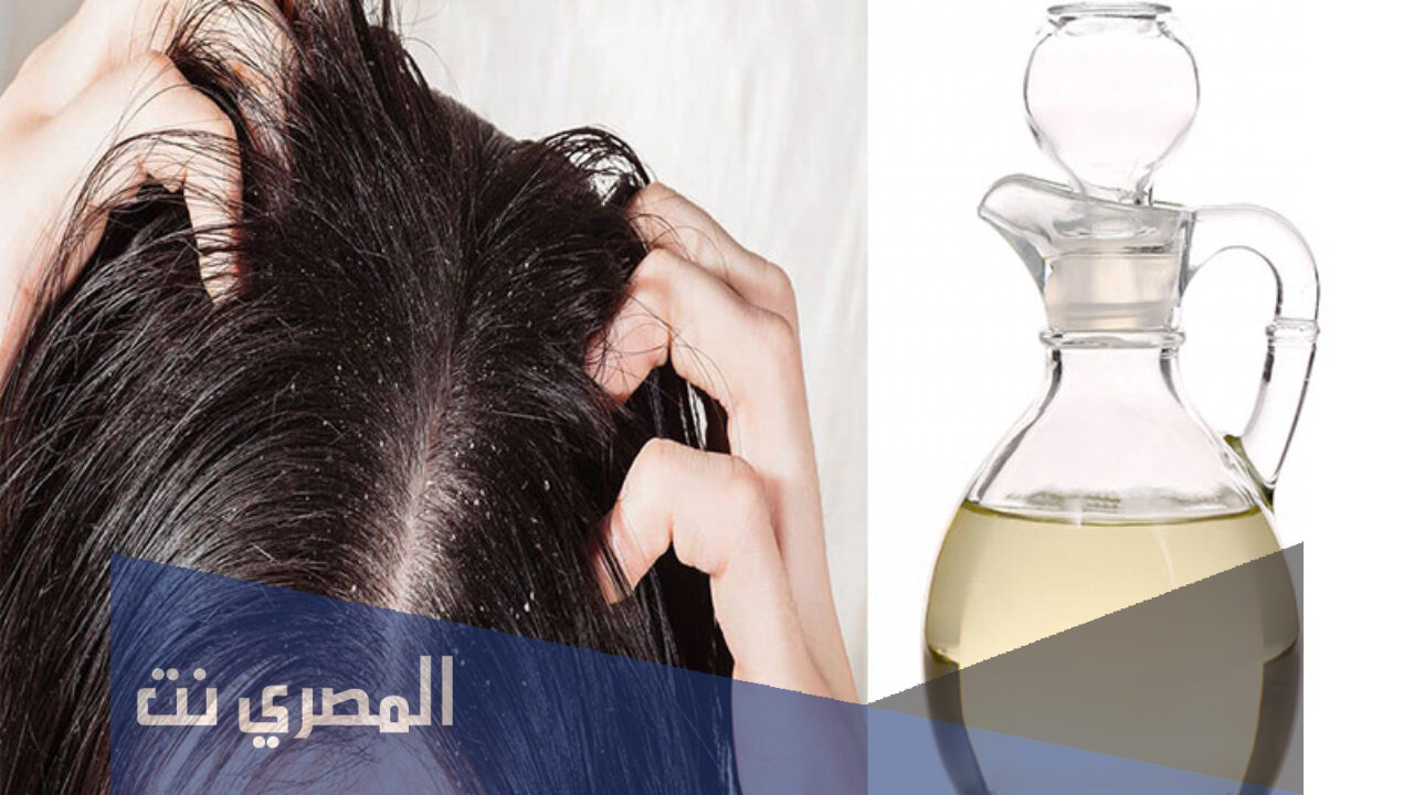 افضل شامبو للقمل وعلاجات منزلية للتخلص من القمل