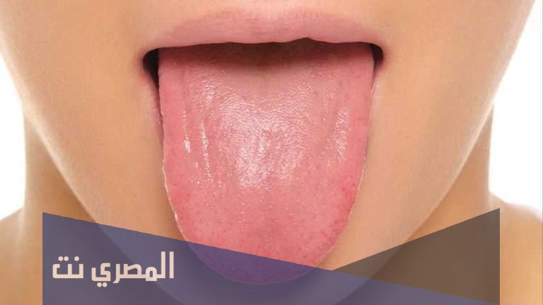 تفسير رؤية اللسان المقطوع في المنام لابن سيرين