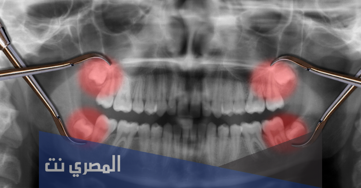 ضرس العقل متى يطلع