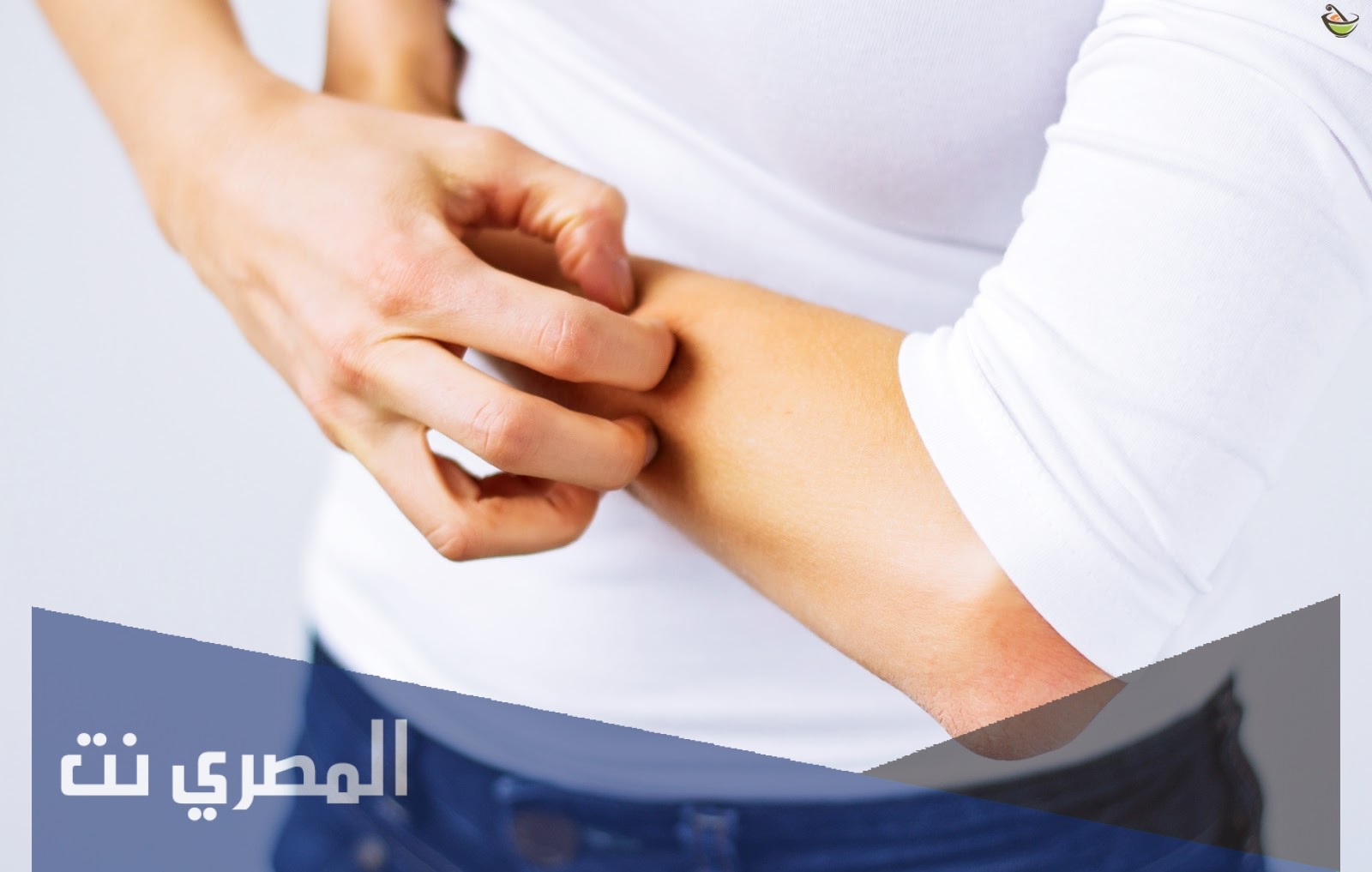 مرهم بلاكوفيرازون Plaquverazon لعلاج الحكة الجلدية