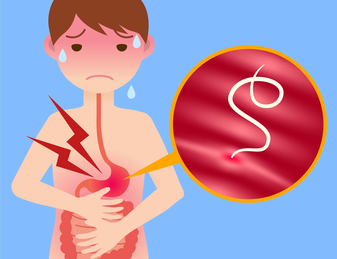 معلومات عن دودة الاسكارس