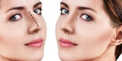 تجميل الأنف بدون عمليات جراحية 