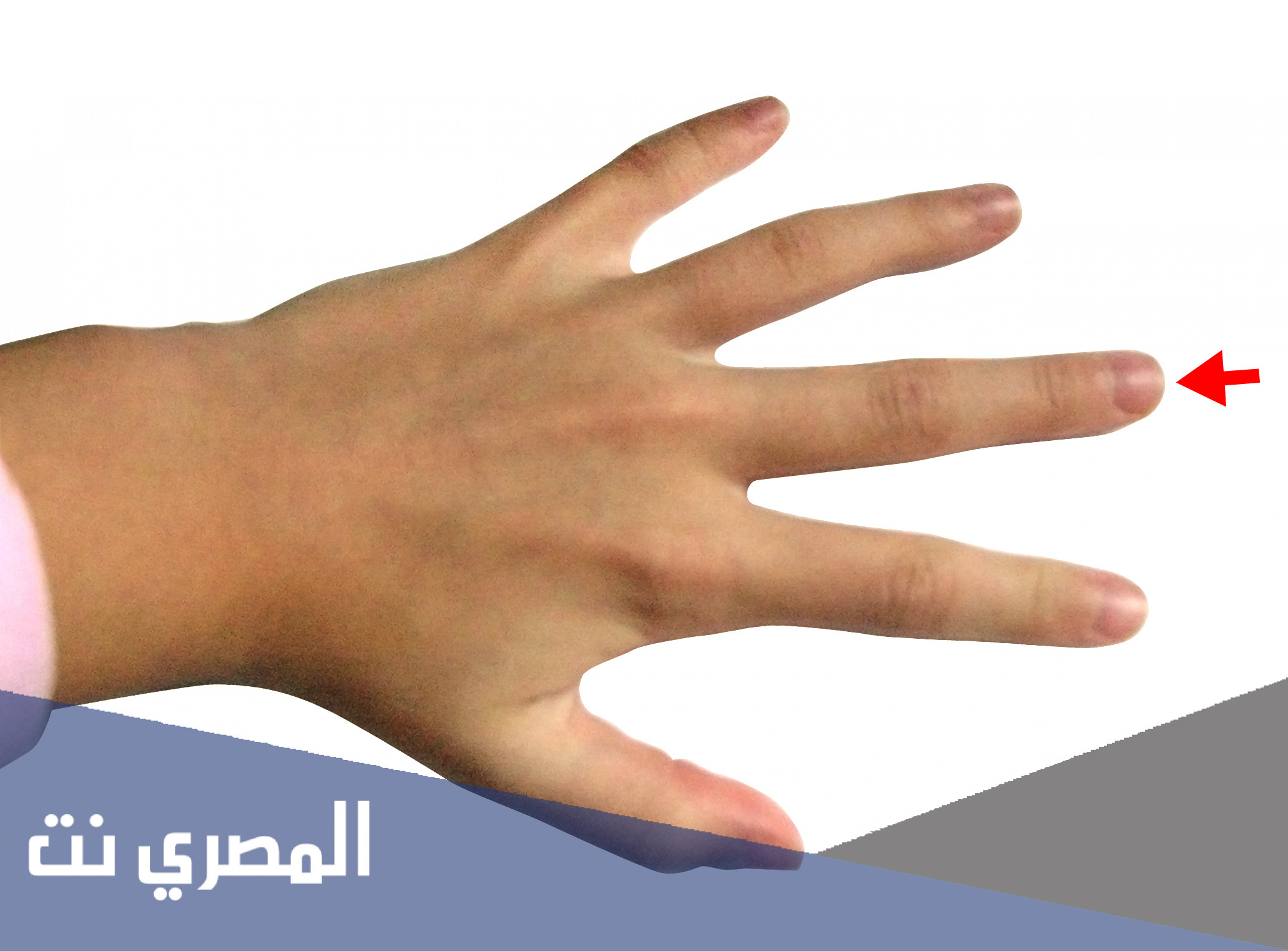 اذا احد صبع لي وش اقول