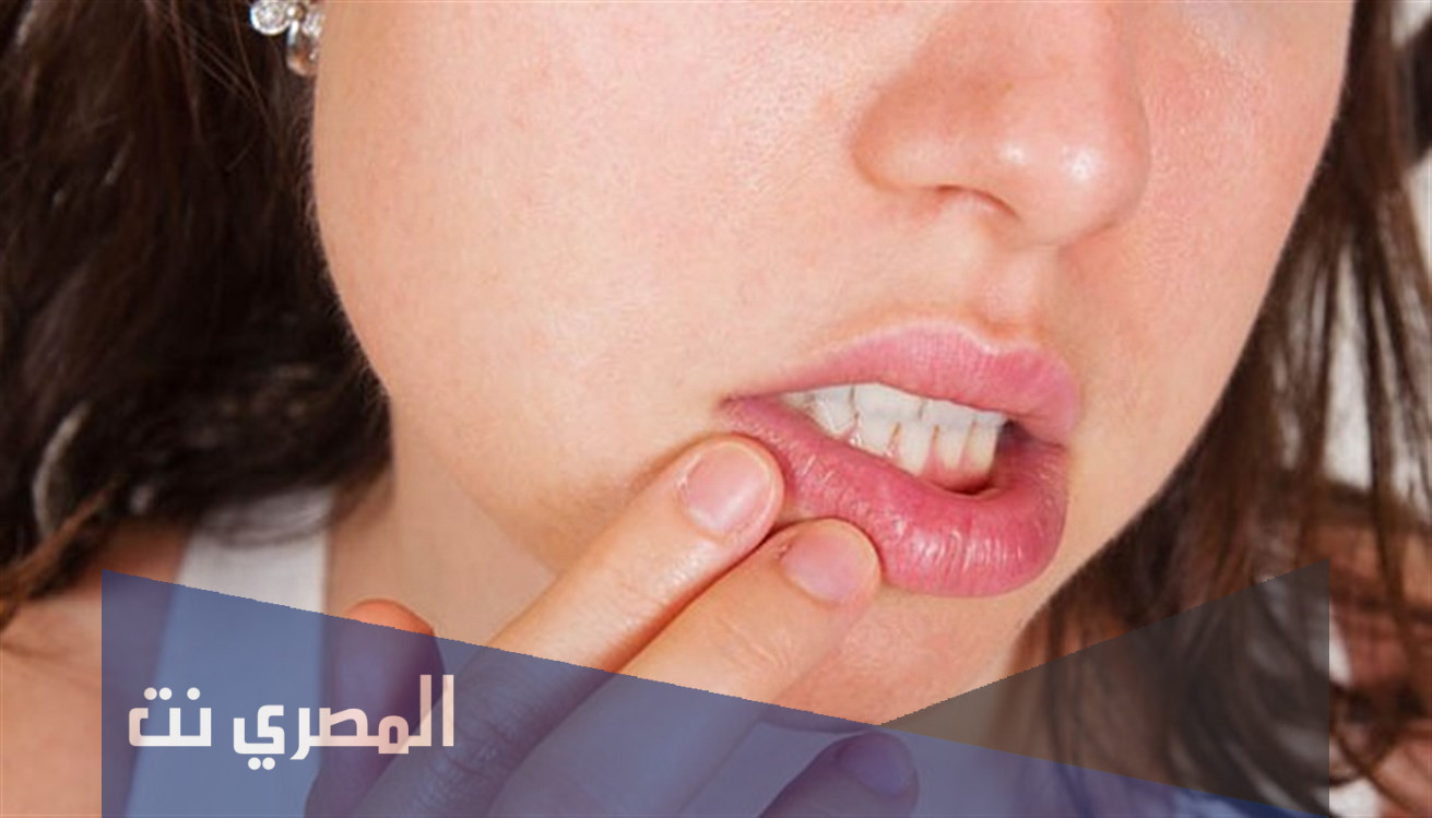 جيل ميراجل Miragel Gel لعلاج فطريات الفم والجرعة المطلوبة