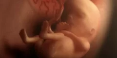نوم الجنين في الرحم هل ينام الجنين في الرحم وكيف ينام