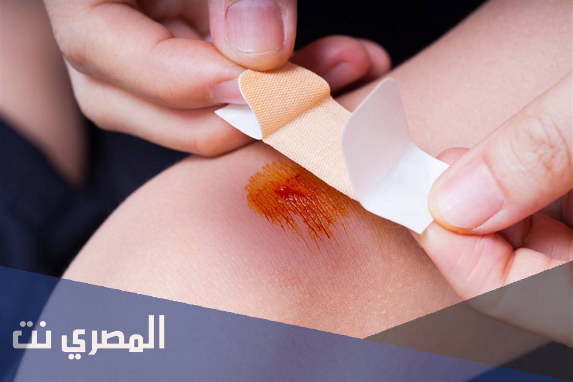 دواء سولكوسيريل Solcoseryl كريم لسرعة شفاء الجروح والتخلص من علاماتها