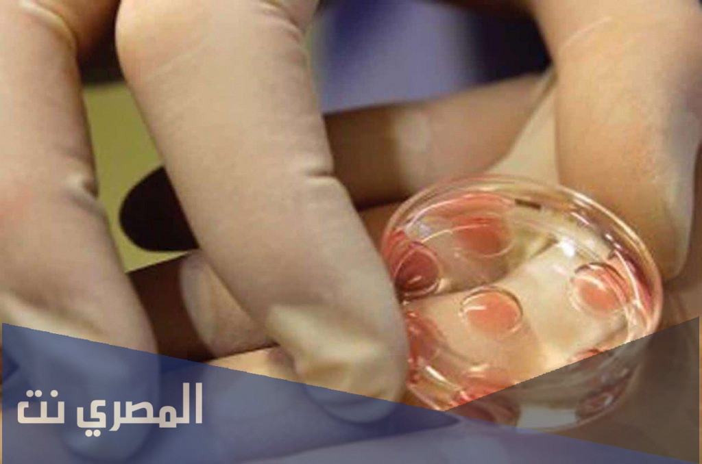 معلومات هامة عن الحقن المجهري