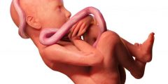 أسباب اختناق الجنين أثناء الولادة