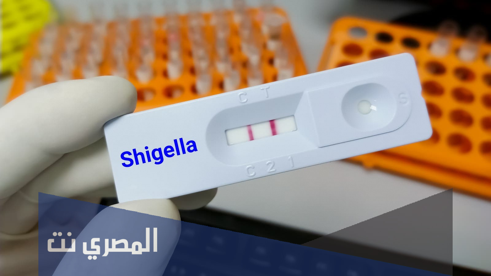 علامات الاصابة بجرثومة شيغيلا