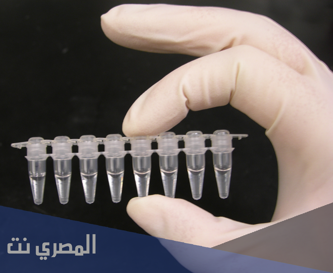 لماذا يستخدم تفاعل البلمرة المتسلسل