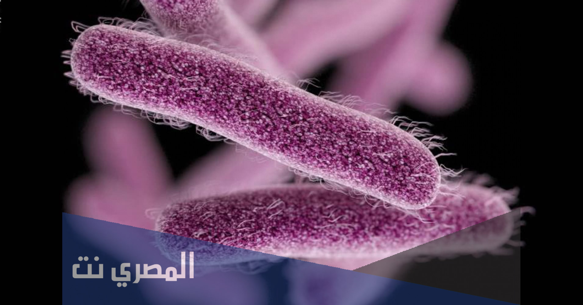 ما هي جرثومة شيغيلا في الأردن
