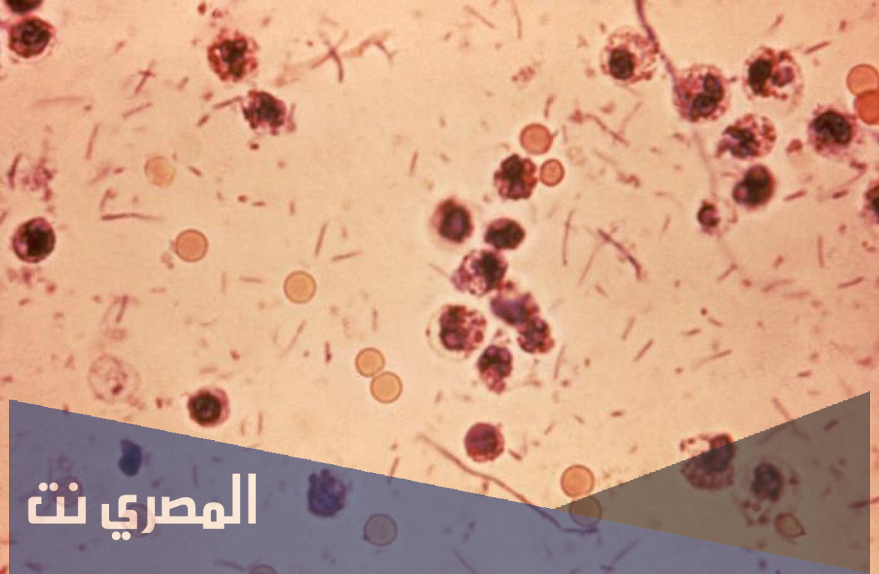 ما هي جرثومة شيغيلا ويكيبيديا