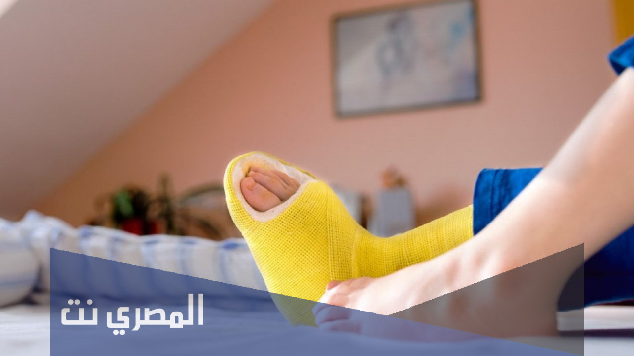 ما هي مدة المسح على الجبيرة