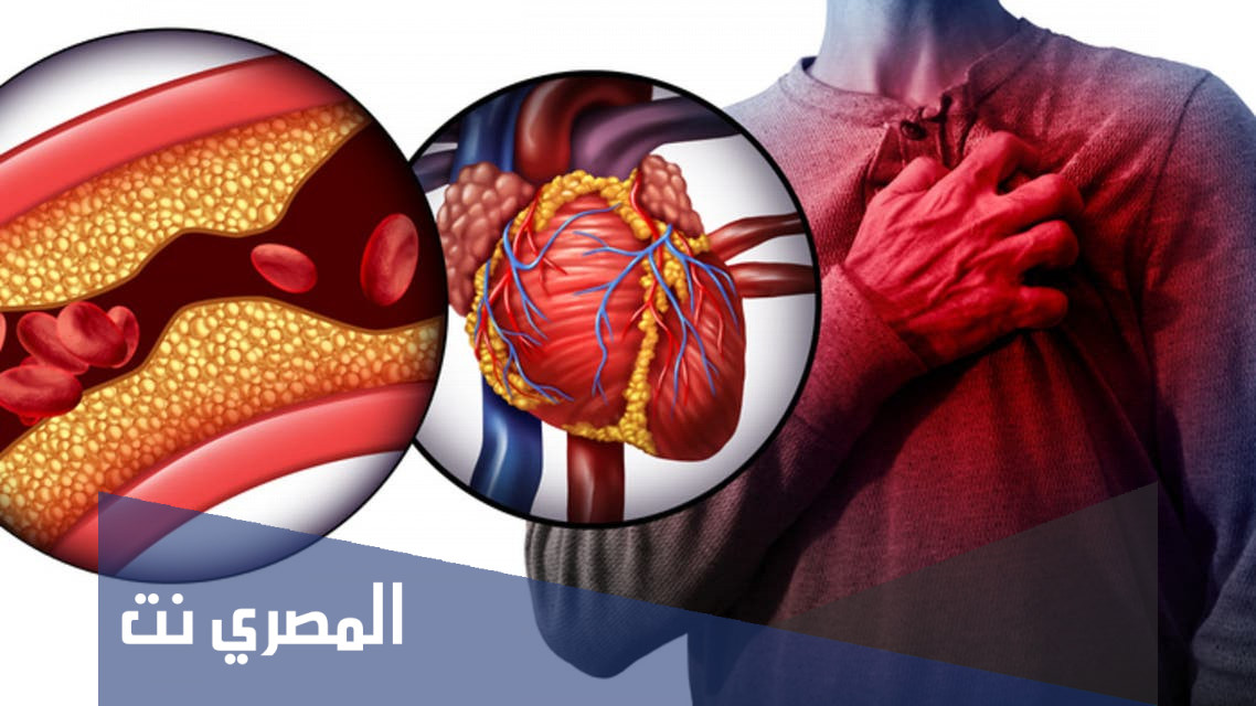 دواء ستارفيت Starvit شراب لعلاج نقص الكوليسترول