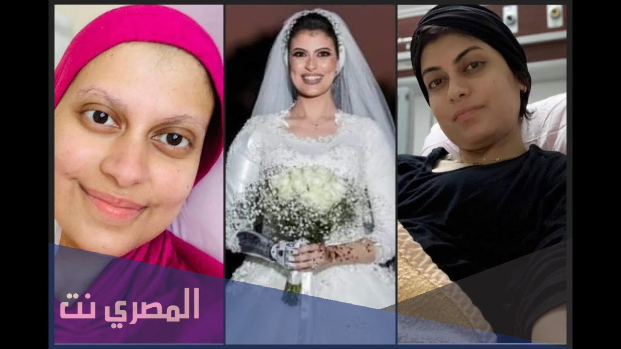 قصة سلمى الزرقا محاربة السرطان