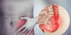 نشرة أقراص سالوفالك لعلاج القولون Salofalk وتأثيره