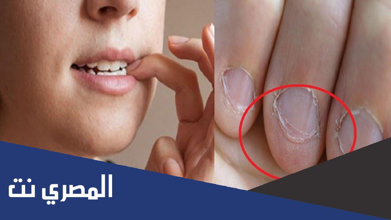 سبب تآكل الاظافر عند الاطفال