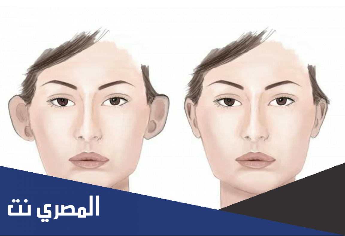 كم تكلفة عملية تجميل الأذن في السعودية