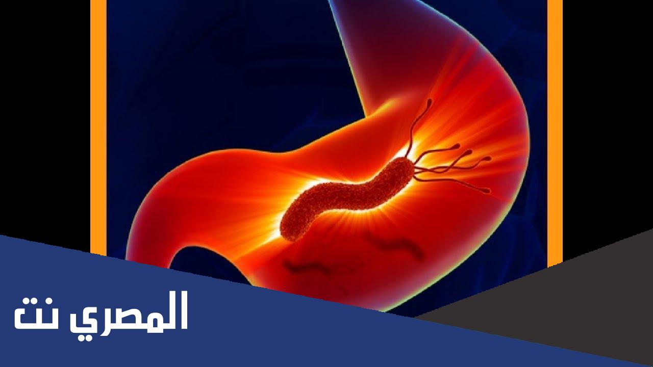 وصفات طبيعية للتخلص من جرثومة المعدة H. pylori