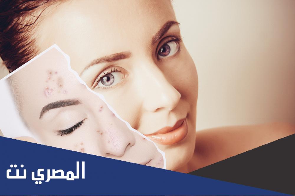 أفضل مقشر للبشرة الدهنية