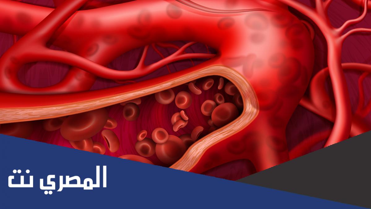 كيف أعرف أن الدورة متأخرة وليس حمل