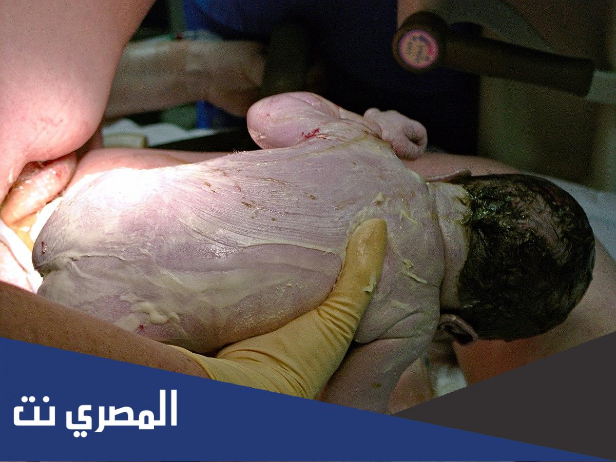 ما وظيفة الطلاء الدهني الجبني