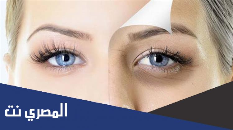 وصفات ازالة الهالات السوداء من تحت العين نهائياً