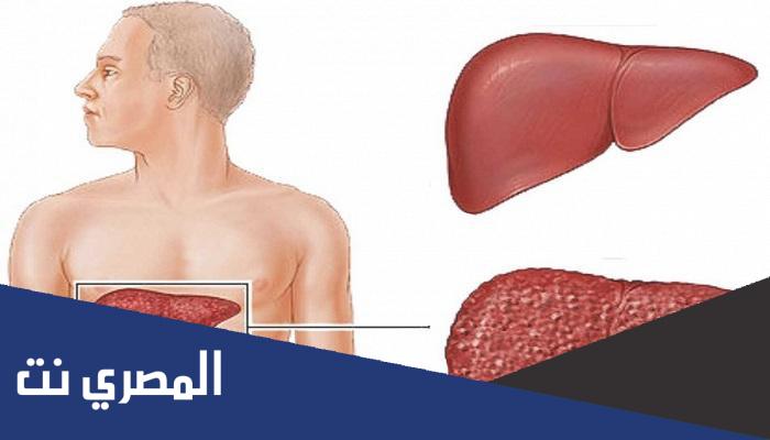 أمبولات بيج انترون Peg- Intron لعلاج التهاب الكبدي الوبائي بالتفصيل