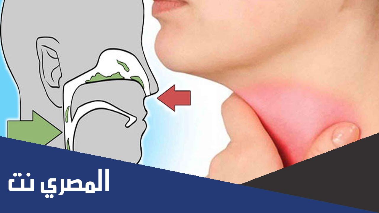 أخطر أنواع البلغم وعلى ماذا يدل ؟