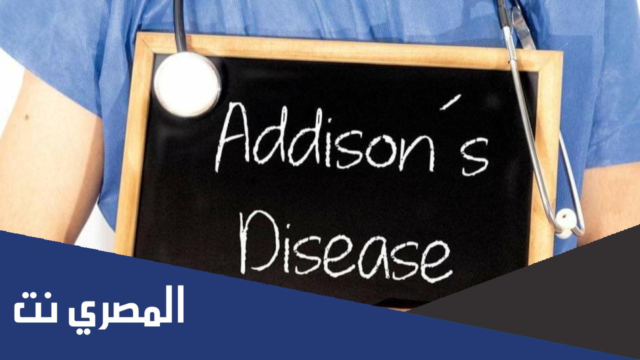 أسباب مرض اديسون وأعراضه