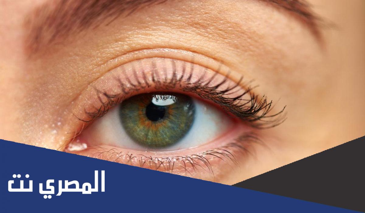 ارتخاء جفن العين أسبابه وعلاجه